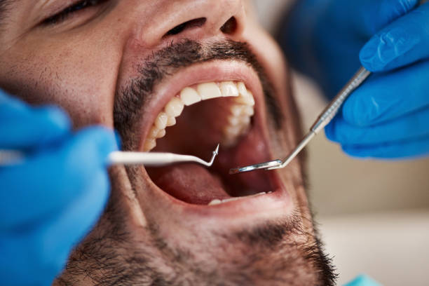 Sedation Dentistry in Clayton, OH